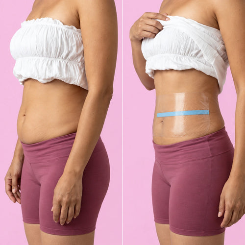 Tersaviva · Cintas lifting para el abdomen (10 cintas)